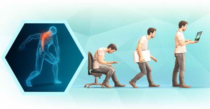 mauvaise posture lorsque l'on travaille sur un ordinateur et ostéochondrose thoracique