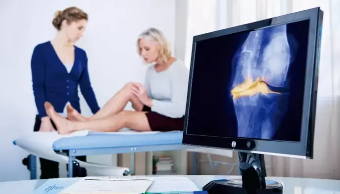 Arthrose de l'articulation chez une femme