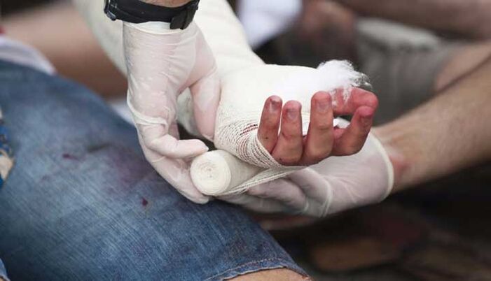 Blessure traumatique à la main, accompagnée de douleurs dans les articulations des doigts